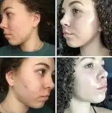 Cerave Créme Lavante Hydratante Peaux Normales à Sèches